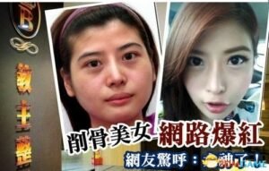 台湾“大妈”削骨变成美女 网友疯狂点赞称太神了